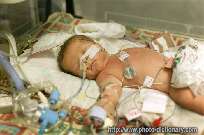 premature baby boy - photo/picture definition - premature baby boy word and phrase image