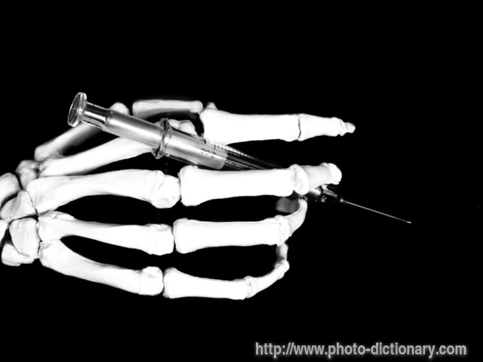skeletal hand - photo/picture definition - skeletal hand word and phrase image