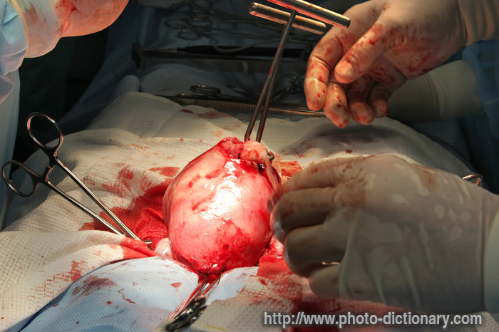 surgery - photo/picture definition - surgery word and phrase image