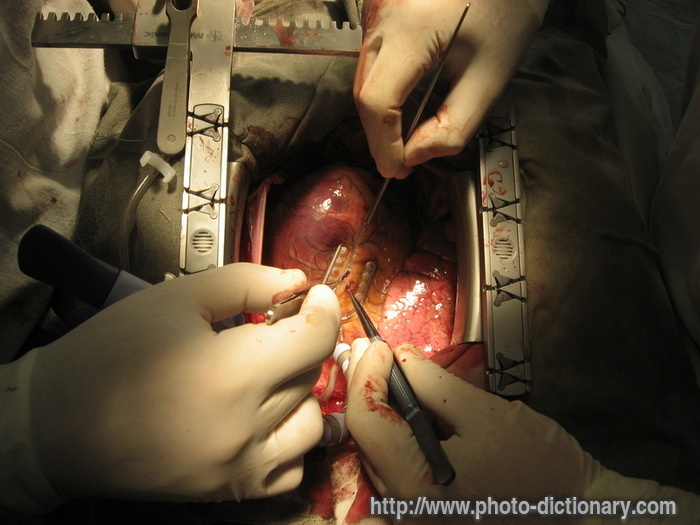 surgery - photo/picture definition - surgery word and phrase image
