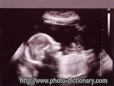 fetus - photo/picture definition - fetus word and phrase image