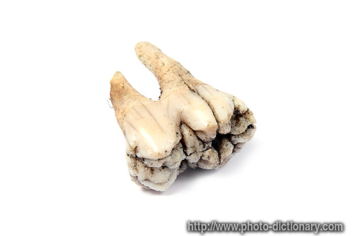 tooth bone - photo/picture definition - tooth bone word and phrase image