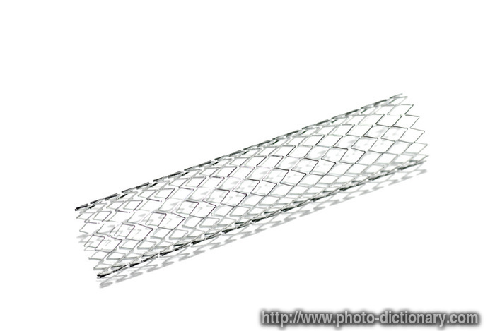stent - photo/picture definition - stent word and phrase image