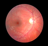retina - photo/picture definition - retina word and phrase image