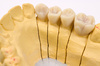 dental wax model - photo/picture definition - dental wax model word and phrase image