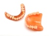 dental prosthesis - photo/picture definition - dental prosthesis word and phrase image